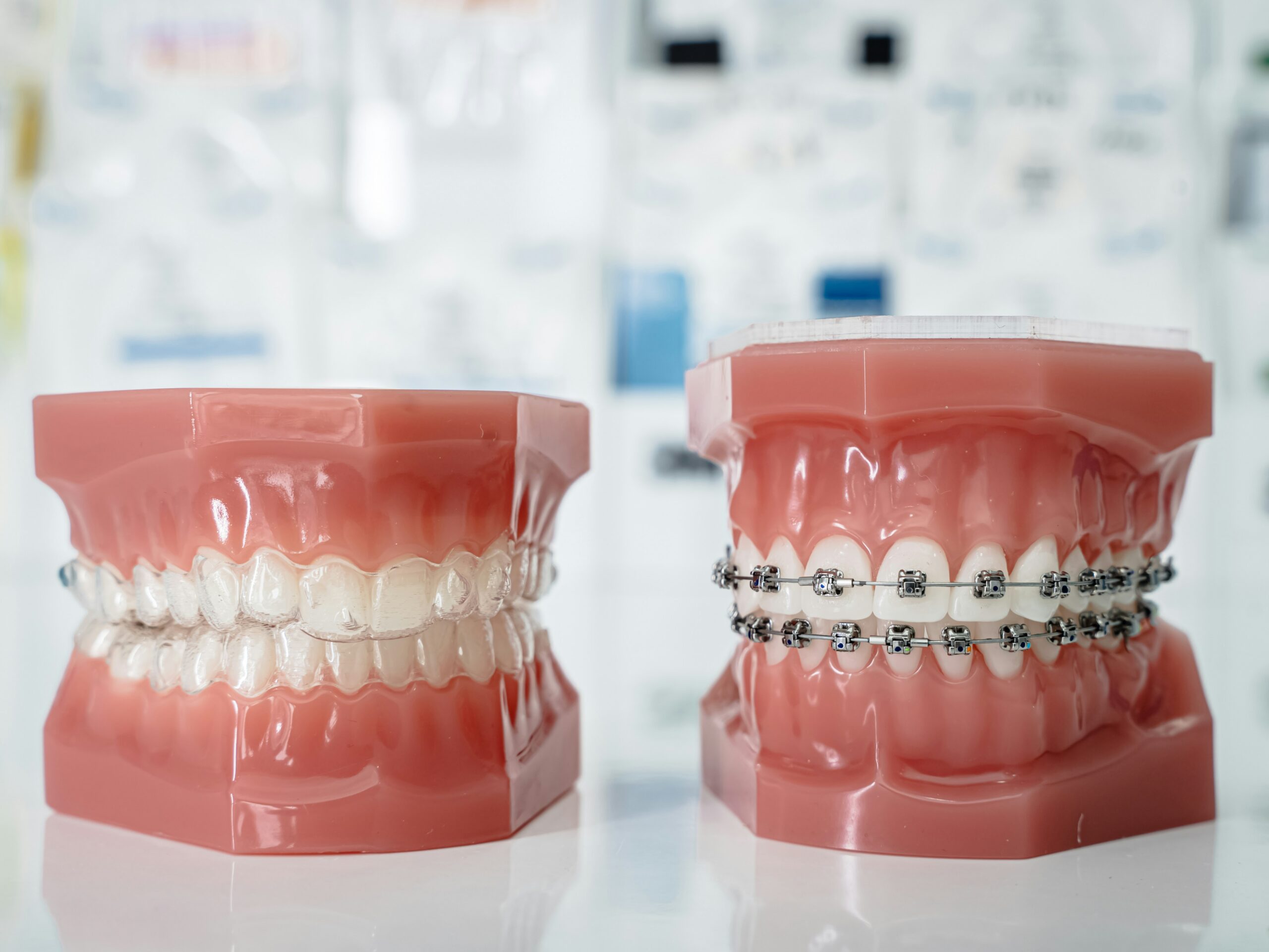 Are Braces Quicker Than Invisalign?
