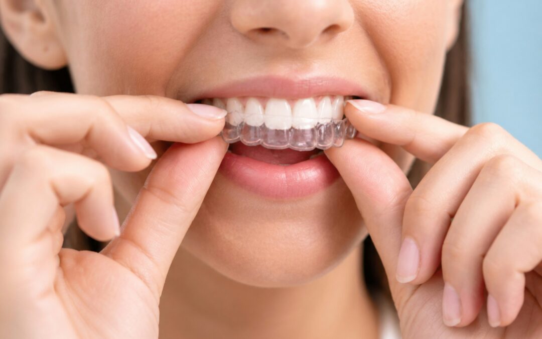 Lost Retainer: What Do I Do?