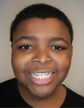 Amir-Before-Face