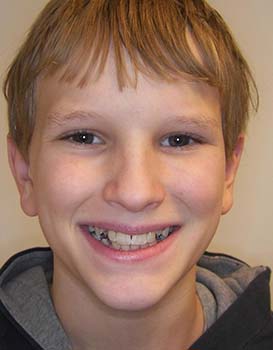 Dillon-Before-Face