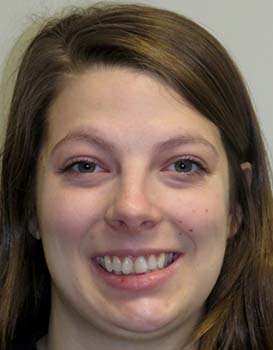 Leah-Before-Face