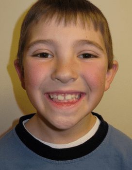 Luke-After-Face