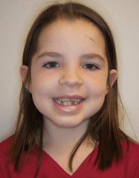 Mara-Before-Face