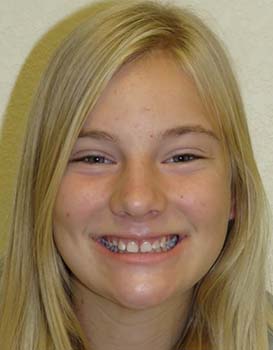 Marin-Before-Face